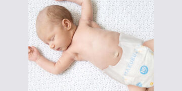 Teruji Jadi Ruam Popok Expert, MAKUKU Perluas Jaringan di 30 Rumah Sakit Tanah Air